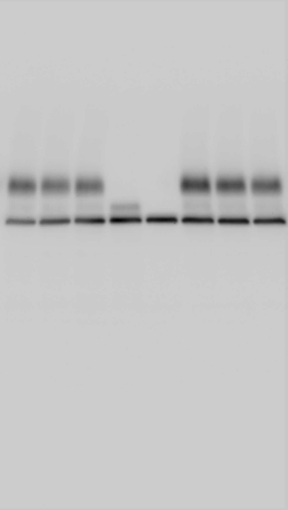 Western blotting, also known as immunoblotting, uses highly specific antibodies to detect proteins of interest in biological samples.