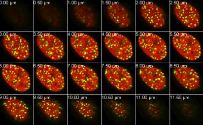 Photo of Irradiated Cells from Linda Yasui Lab