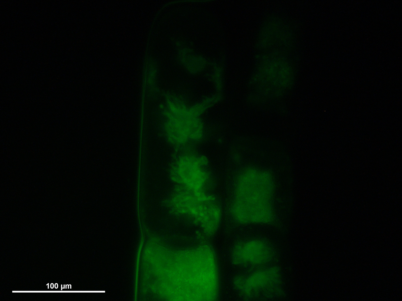 Green fluorescence image captured by Xuehuan Feng, featuring star-shaped chloroplast morphology in green algae (Zygnema circumcarinatum).