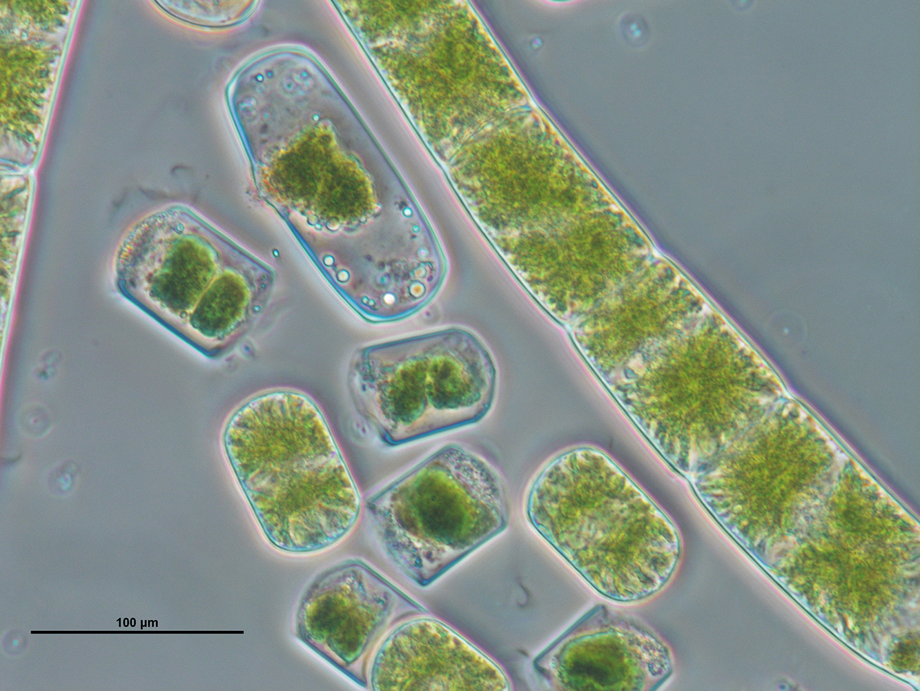 Brightfield image captured by Xuehuan Feng, featuring conjugating green algae with unbranched filaments (Zygnema circumcarinatum).