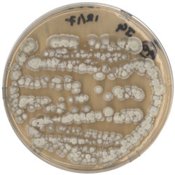 Petri dis of streptomyces