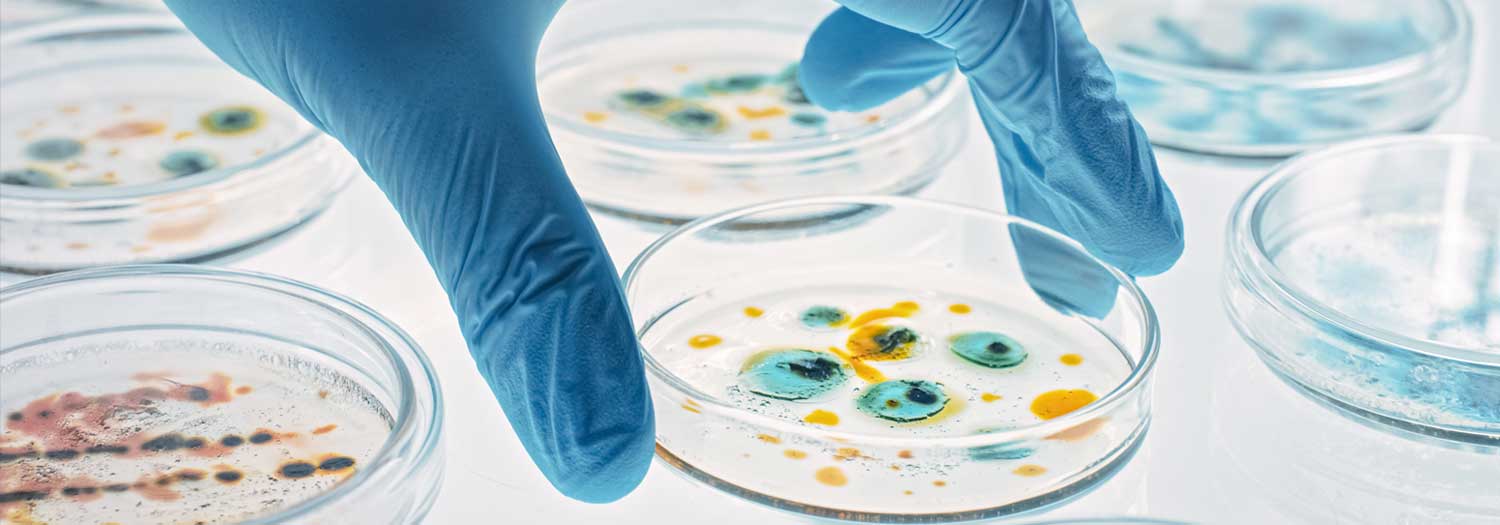 Scientist Works with Petri Dishes with Various Bacteria, Tissue and Blood Samples.