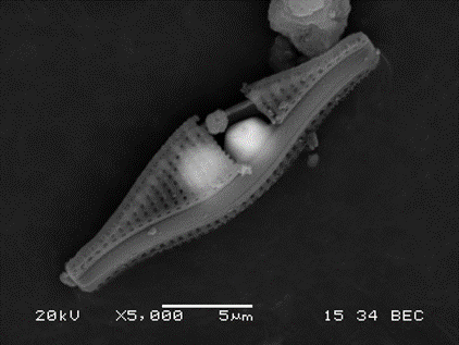 A diatom with a grain stuck inside it 2