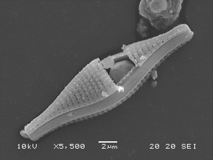 A diatom with a grain stuck inside it