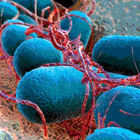 Shiga-toxin Producing E. coli